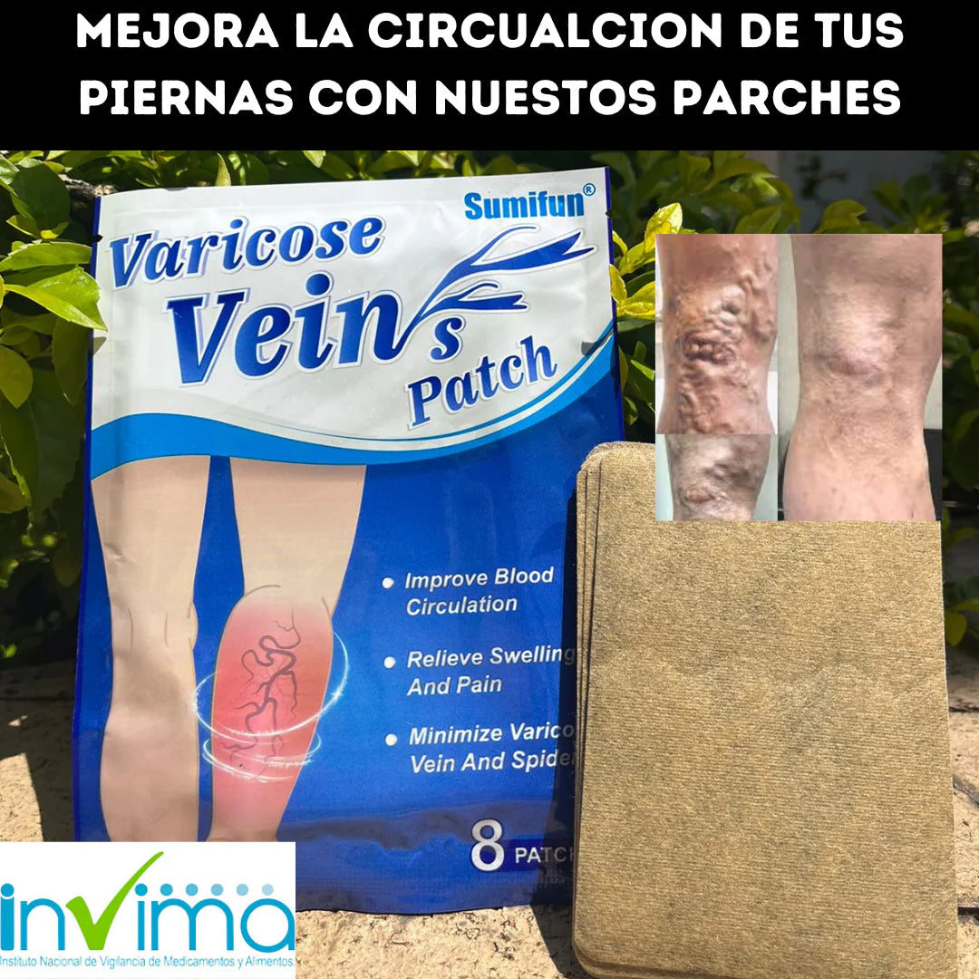 Por fin podras eliminar las horribles varices